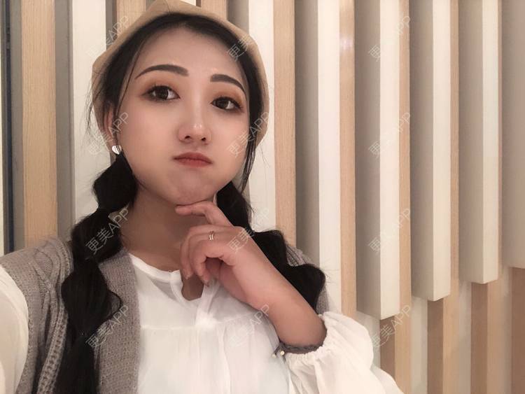 更美 - 更美用户wQDaXLbprp的玻尿酸鼻部经验 | 广州 | 玻尿酸鼻部
