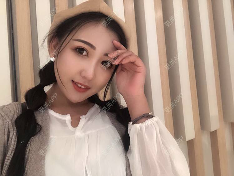 更美 - 更美用户wQDaXLbprp的玻尿酸鼻部经验 | 广州 | 玻尿酸鼻部