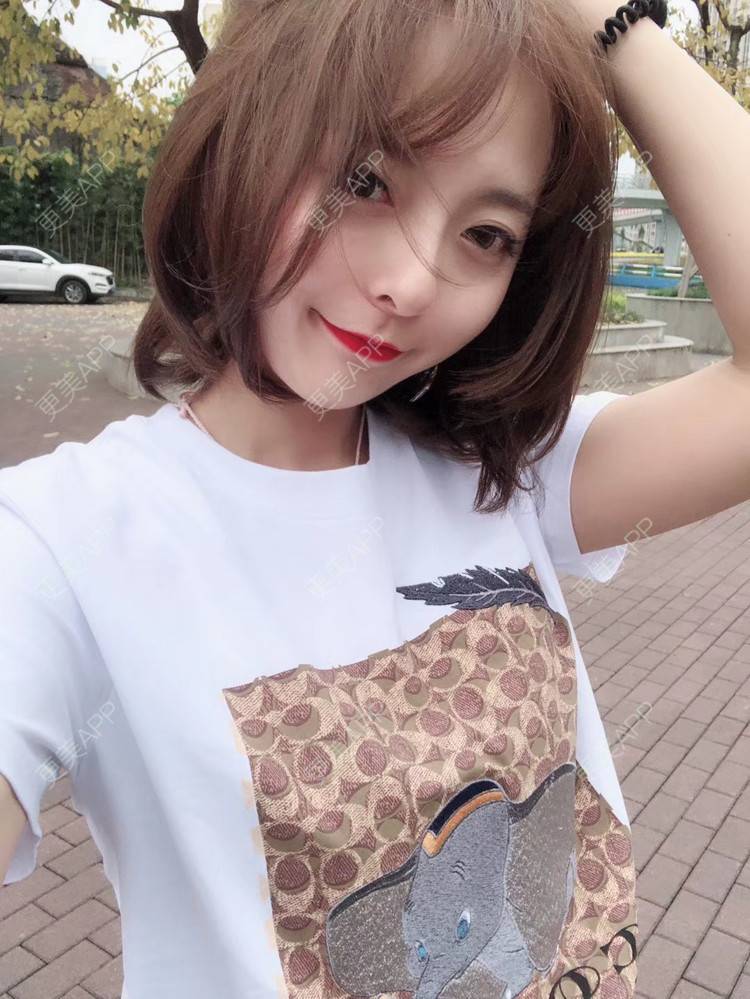 更美 - 更美用户9Nt11KbhXj的自体脂肪全面部填充经验 | 广州 | 自体脂肪全面部填充 | 视频日记
