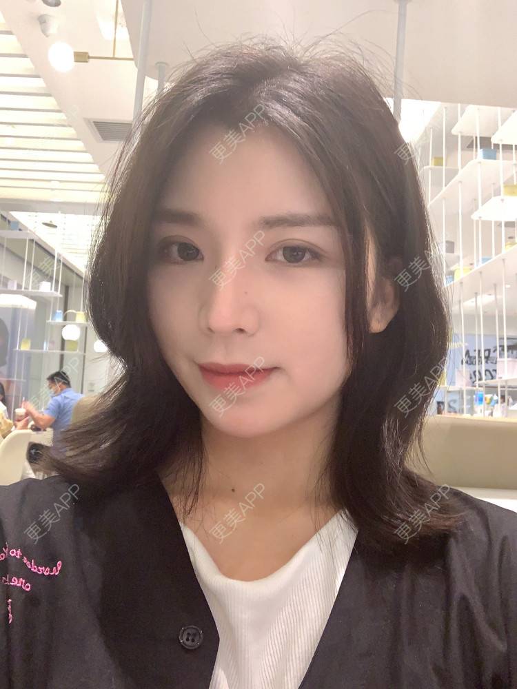 更美 - 更美用户B670A6hUBe的眼部综合经验 | 广州 | 眼部综合