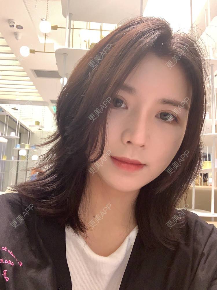 更美 - 更美用户B670A6hUBe的眼部综合经验 | 广州 | 眼部综合