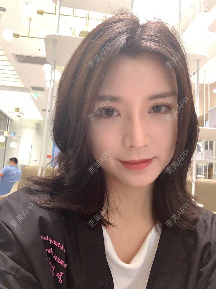 更美 - 更美用户B670A6hUBe的眼部综合经验 | 广州 | 眼部综合