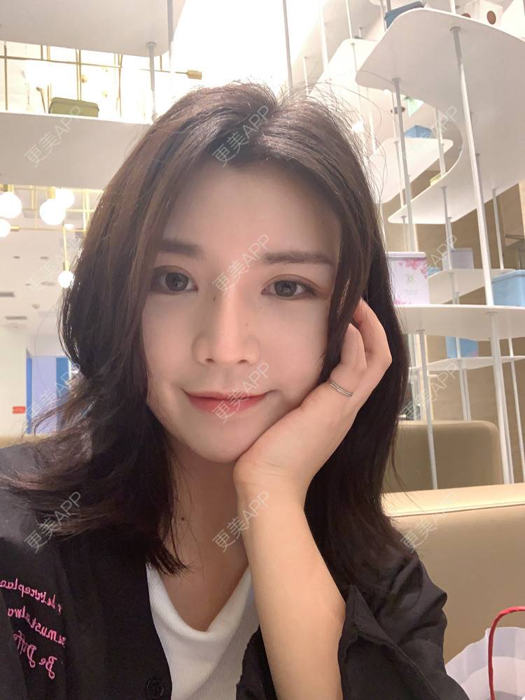 更美 - 更美用户B670A6hUBe的眼部综合经验 | 广州 | 眼部综合