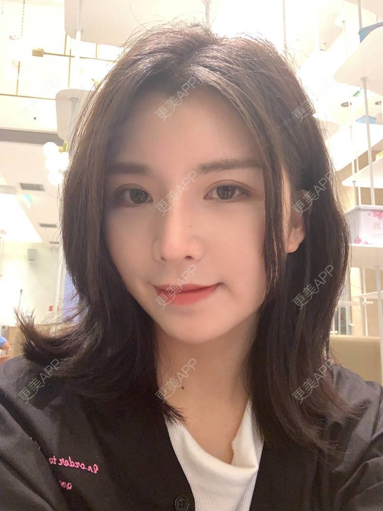 更美 - 更美用户B670A6hUBe的眼部综合经验 | 广州 | 眼部综合