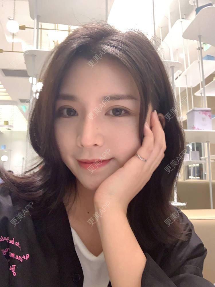更美 - 更美用户B670A6hUBe的眼部综合经验 | 广州 | 眼部综合