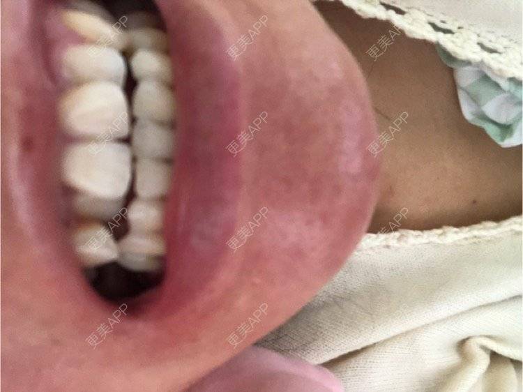 更美 - 更美用户KypVf5ovVE的经验 | 上海