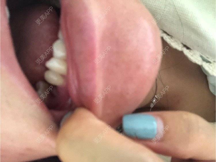 更美 - 更美用户KypVf5ovVE的经验 | 上海