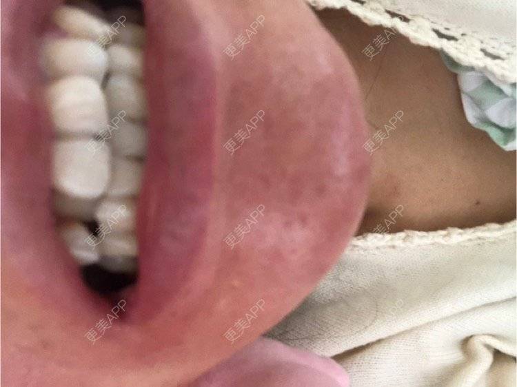 更美 - 更美用户KypVf5ovVE的经验 | 上海