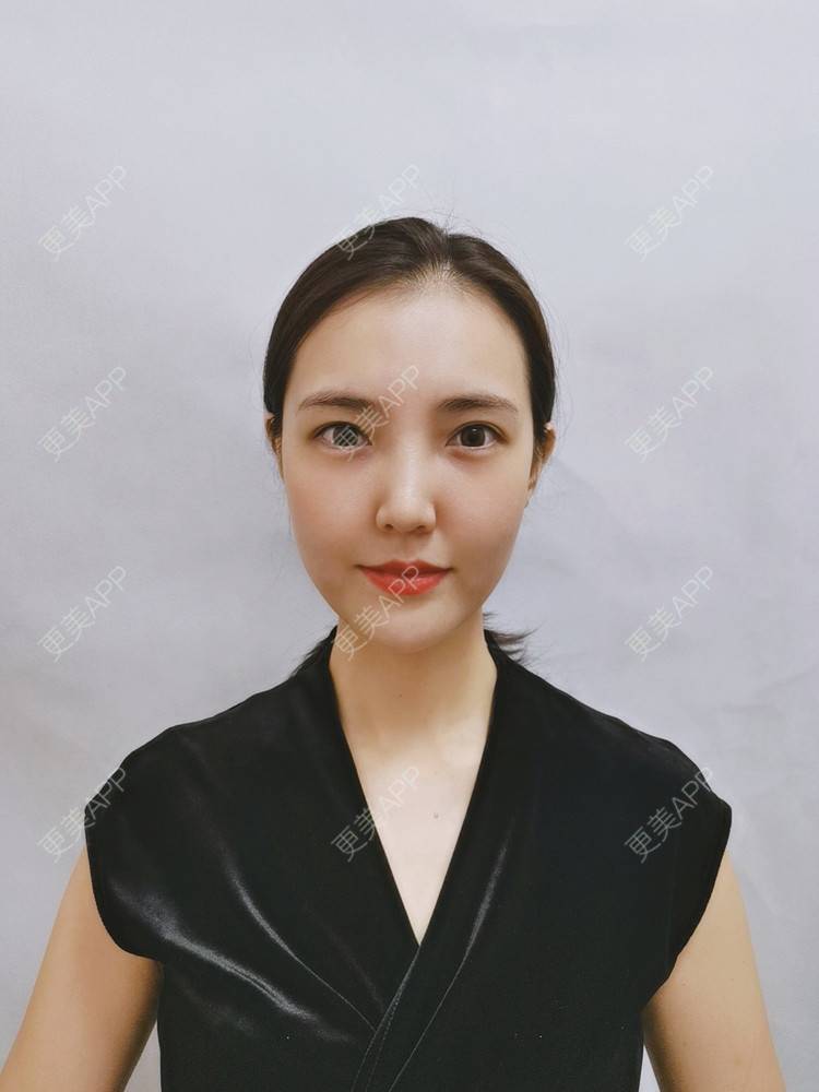 更美 - 更美用户I615A5dR3m的热玛吉经验 | 热玛吉 | 三亚