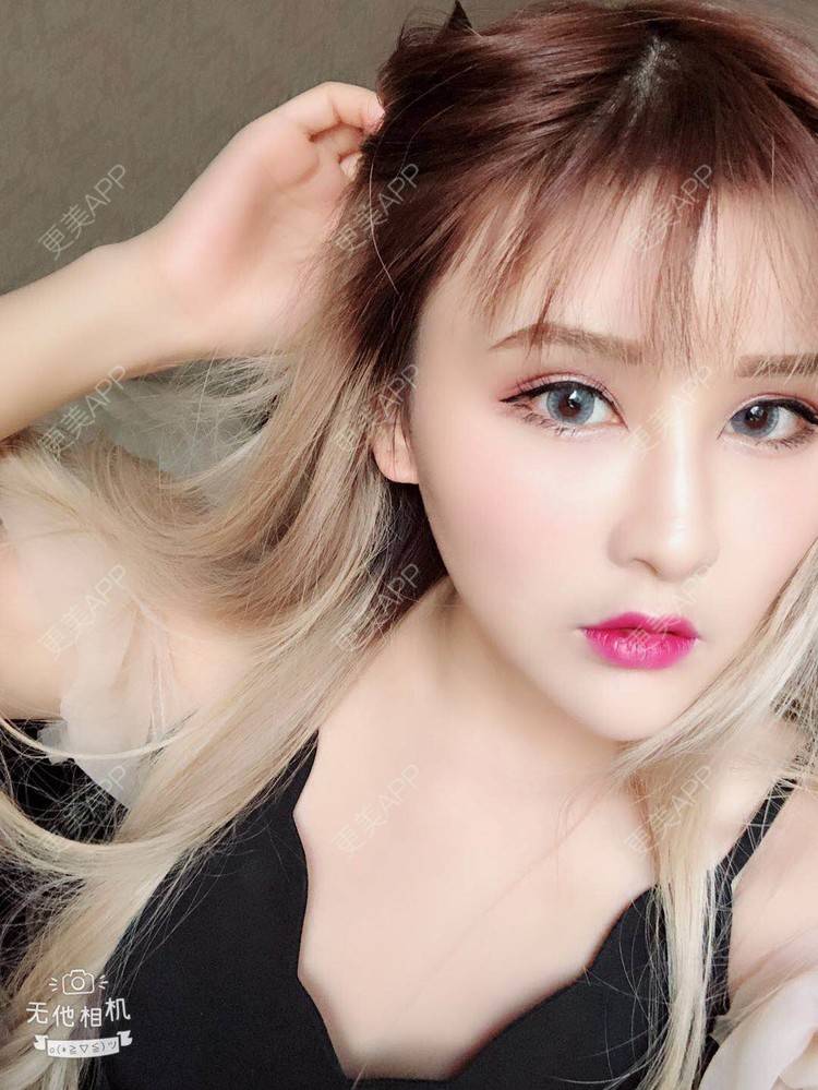 更美 - 阿依古丽💫的全切双眼皮经验 | 视频日记 | 全切双眼皮 | 重庆