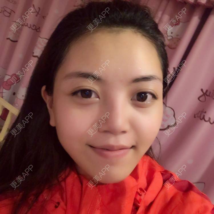 更美 - 一条狗的使命的鼻部多项经验 | 鼻部多项 | 重庆