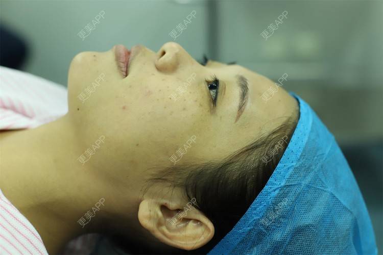更美 - 更美用户I615A5dR3m的鼻部多项经验 | 鼻部多项 | 三亚