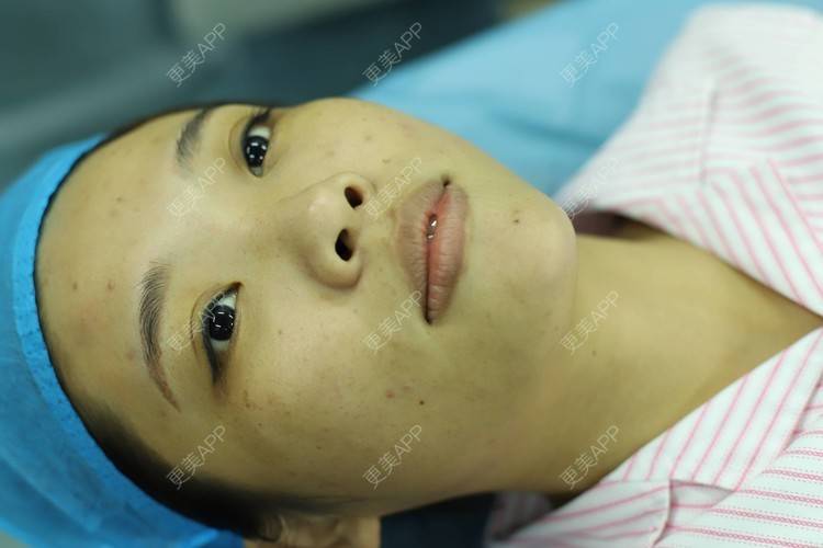 更美 - 更美用户I615A5dR3m的鼻部多项经验 | 鼻部多项 | 三亚
