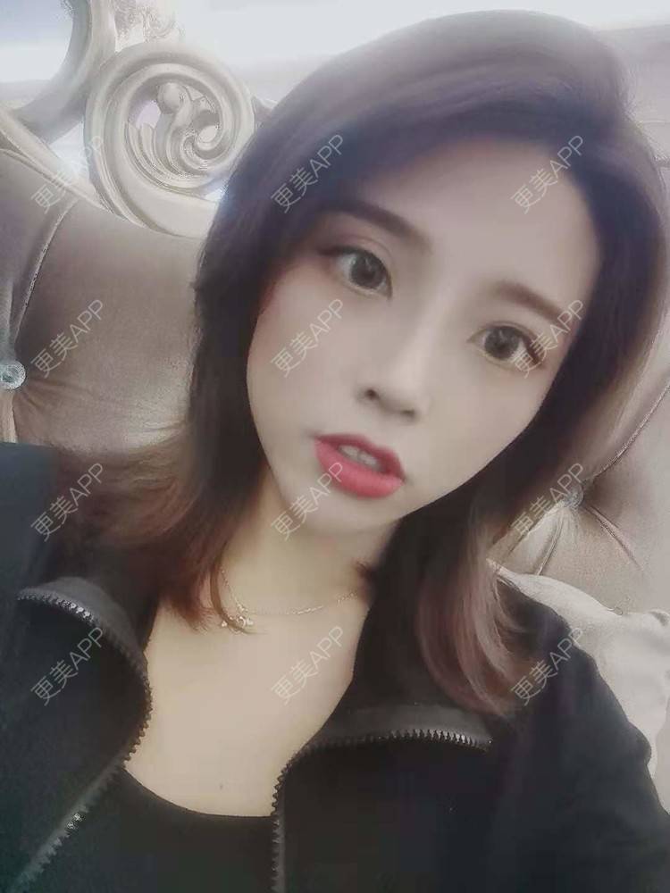 更美 - 更美用户I615A5dR3m的鼻部多项经验 | 鼻部多项 | 三亚