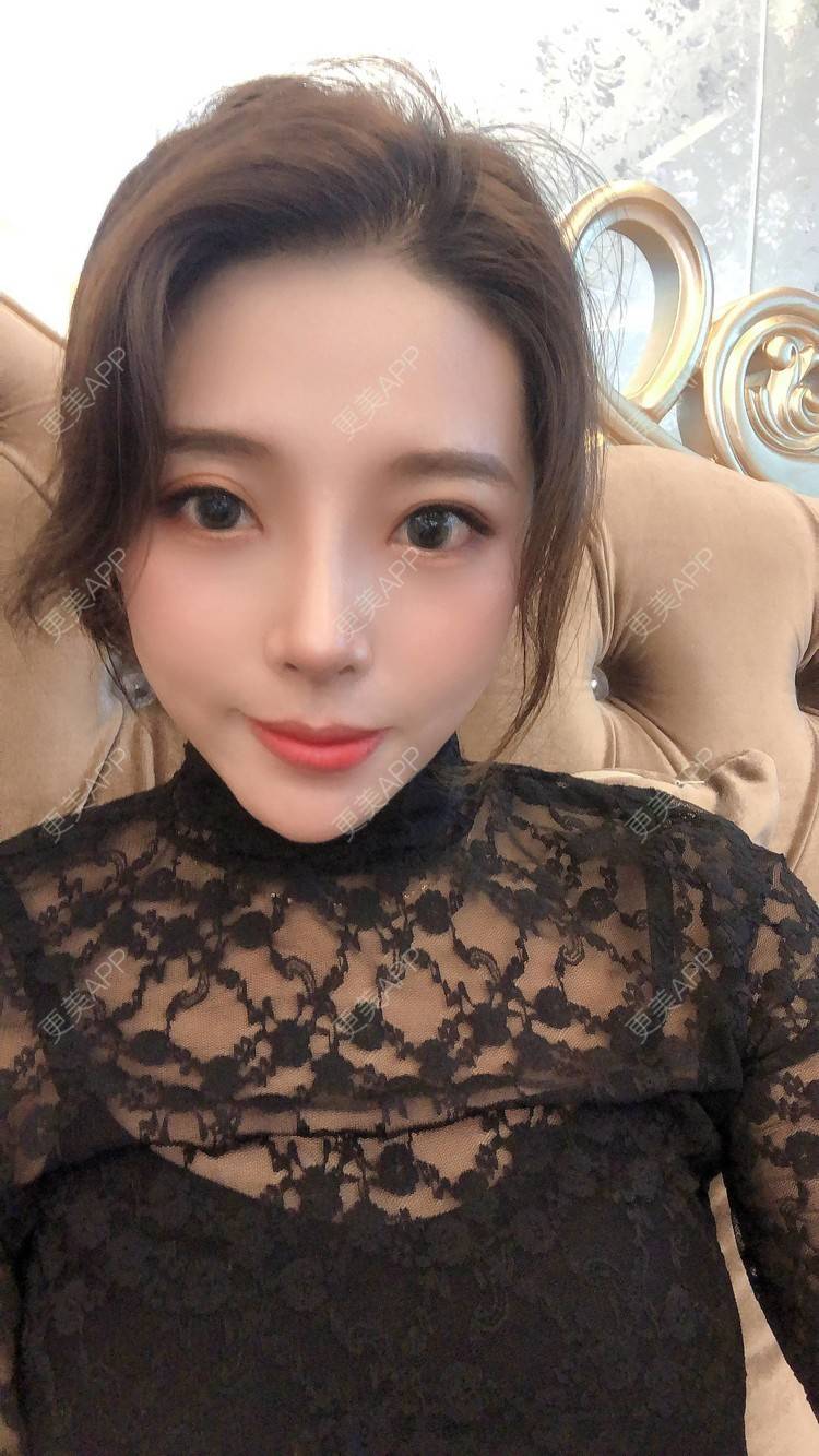 更美 - 更美用户I615A5dR3m的鼻部多项经验 | 鼻部多项 | 三亚
