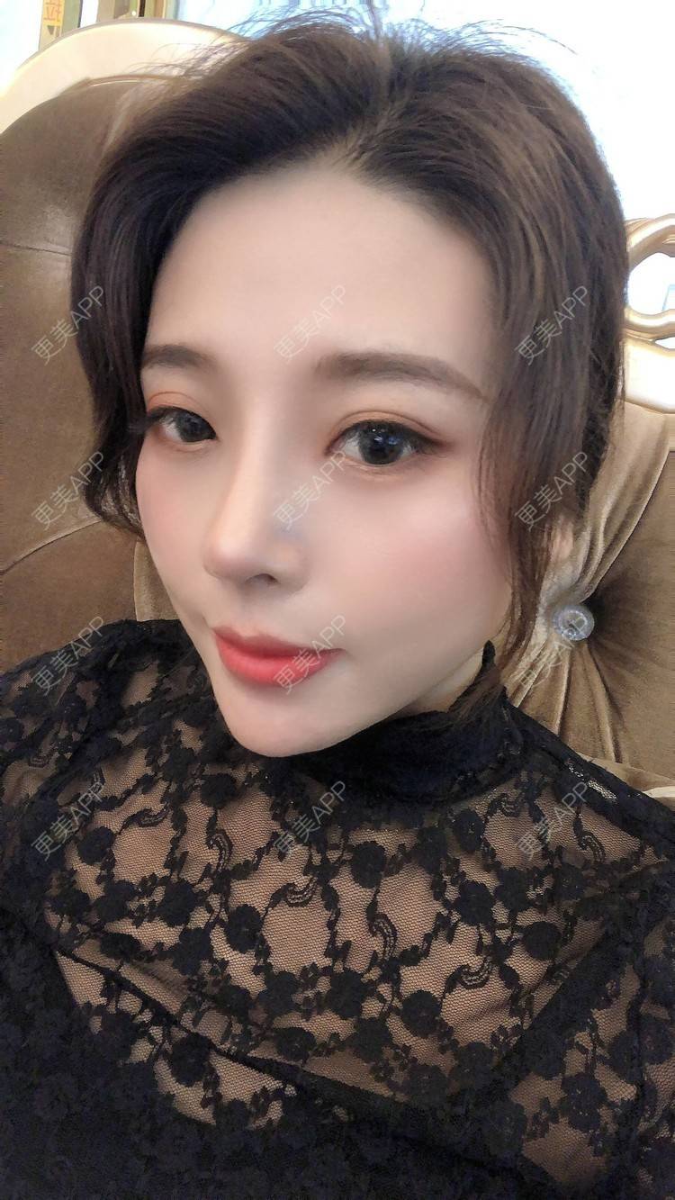 更美 - 更美用户I615A5dR3m的鼻部多项经验 | 鼻部多项 | 三亚