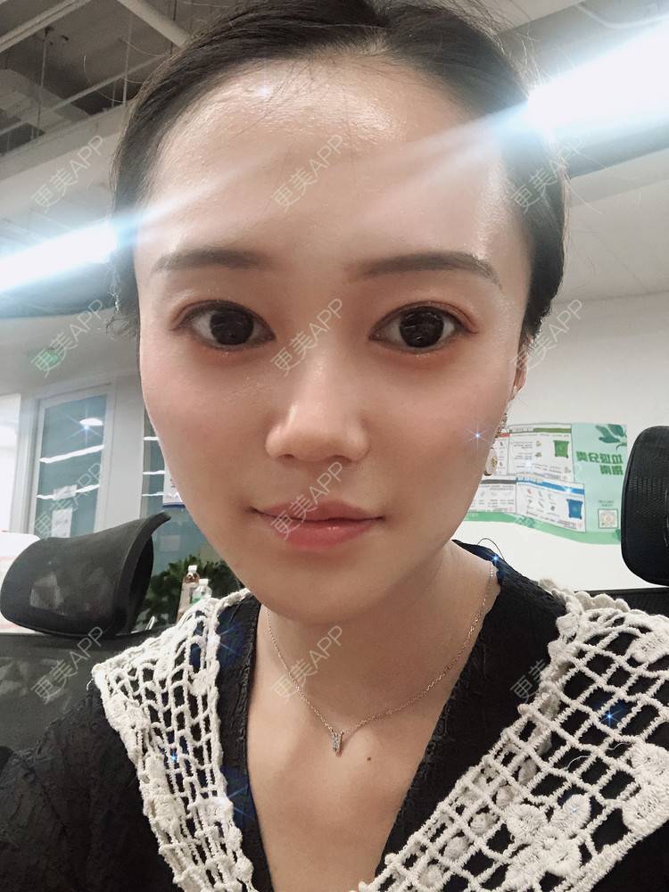 更美 - 午午的下颌角经验 | 成都 | 视频日记 | 下颌角