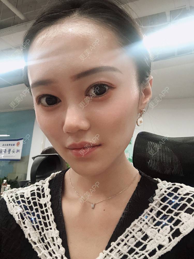 更美 - 午午的下颌角经验 | 成都 | 视频日记 | 下颌角