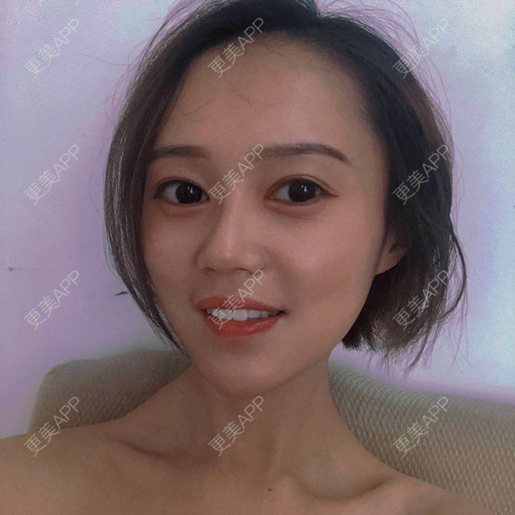 更美 - 午午的下颌角经验 | 成都 | 视频日记 | 下颌角