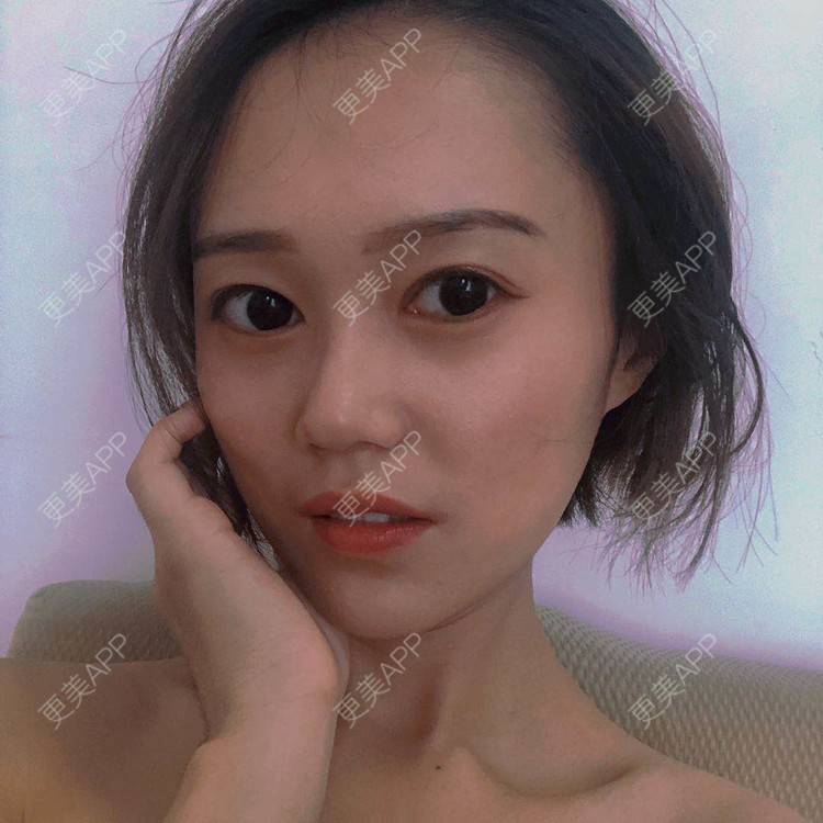 更美 - 午午的下颌角经验 | 成都 | 视频日记 | 下颌角