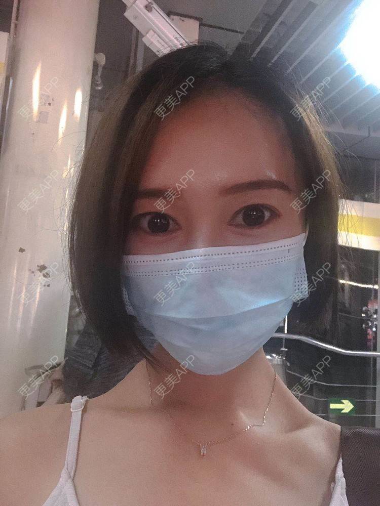 更美 - 午午的下颌角经验 | 成都 | 视频日记 | 下颌角