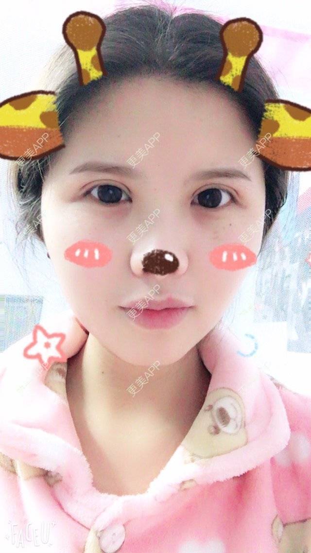 更美用户4ROkc6eciF的眼综合