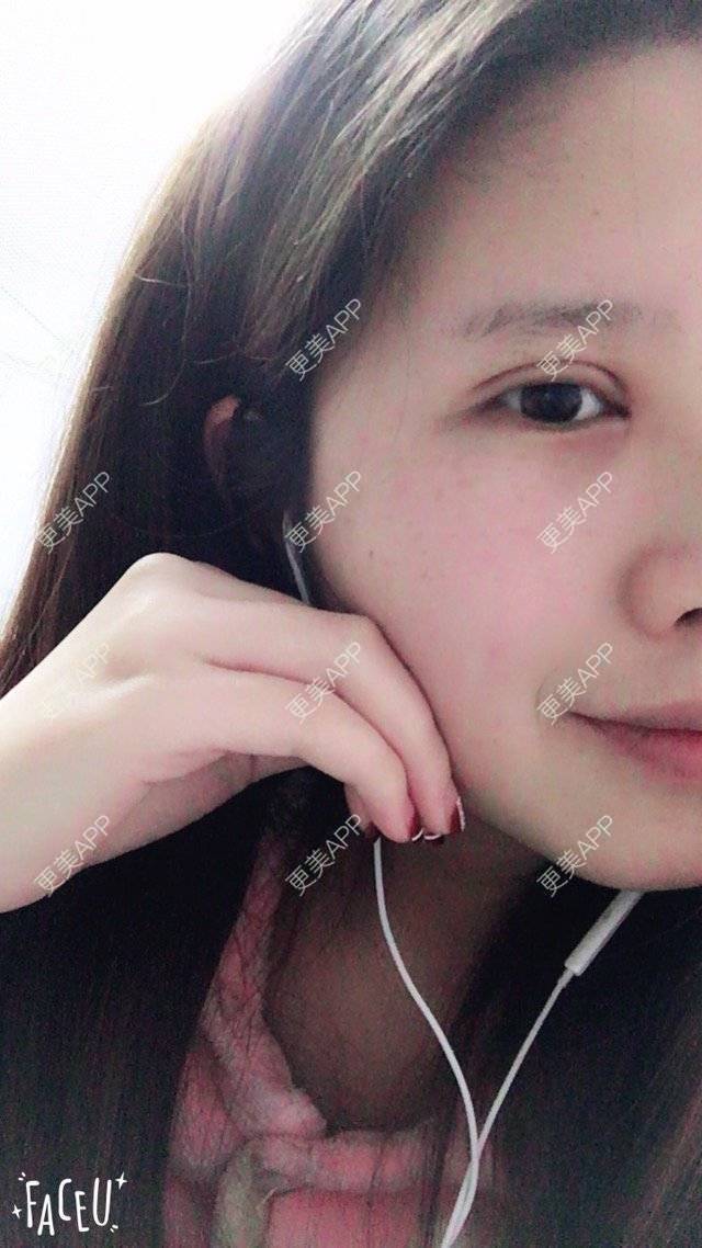 更美用户4ROkc6eciF的眼综合