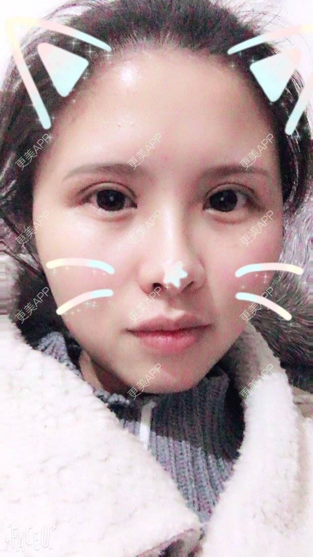 更美用户4ROkc6eciF的眼综合