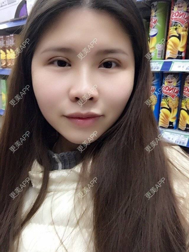 更美用户4ROkc6eciF的眼综合