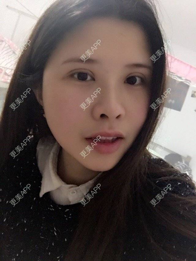 更美用户4ROkc6eciF的眼综合