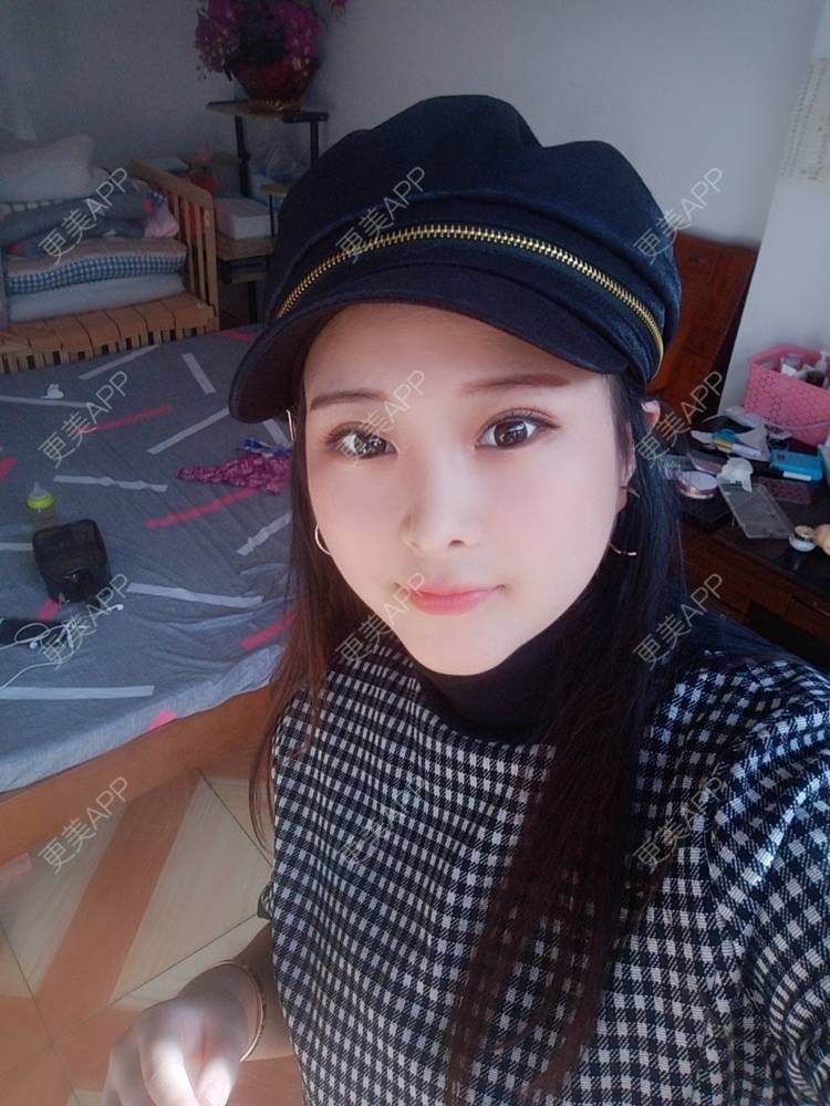 更美 - WildBoy的鼻部综合经验 | 福州 | 视频日记 | 鼻部综合