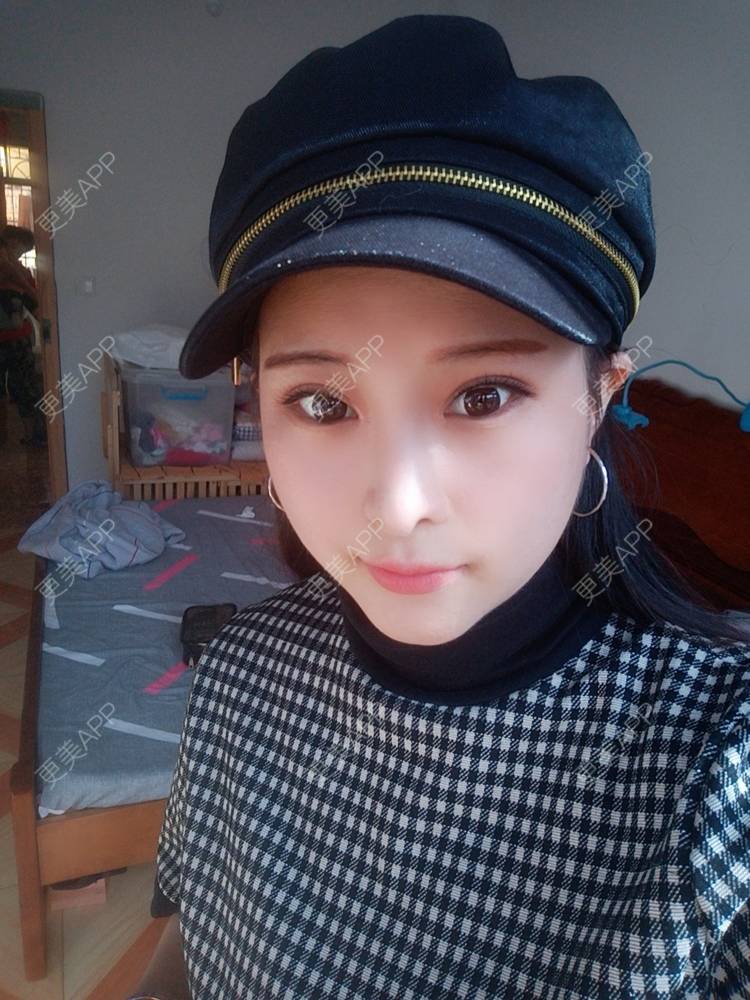 更美 - WildBoy的鼻部综合经验 | 福州 | 视频日记 | 鼻部综合