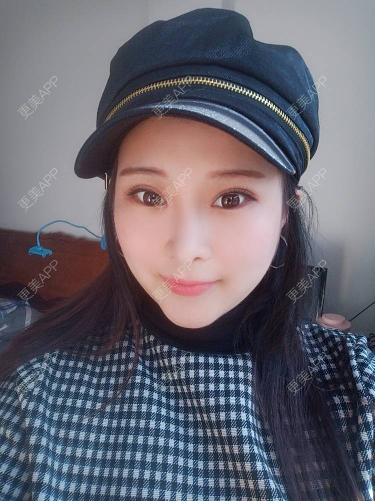 更美 - WildBoy的鼻部综合经验 | 福州 | 视频日记 | 鼻部综合