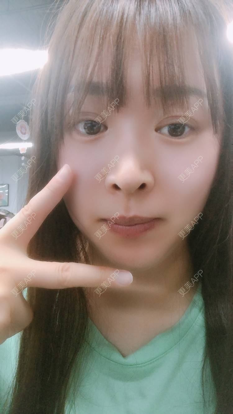 更美 - 更美用户nOSa2OXrxm的冷光美白经验 | 北京 | 冷光美白