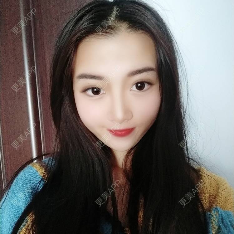 更美 - 更美用户3yM88ohDcE的眼部多项经验 | 眼部多项 | 广州 | 视频日记