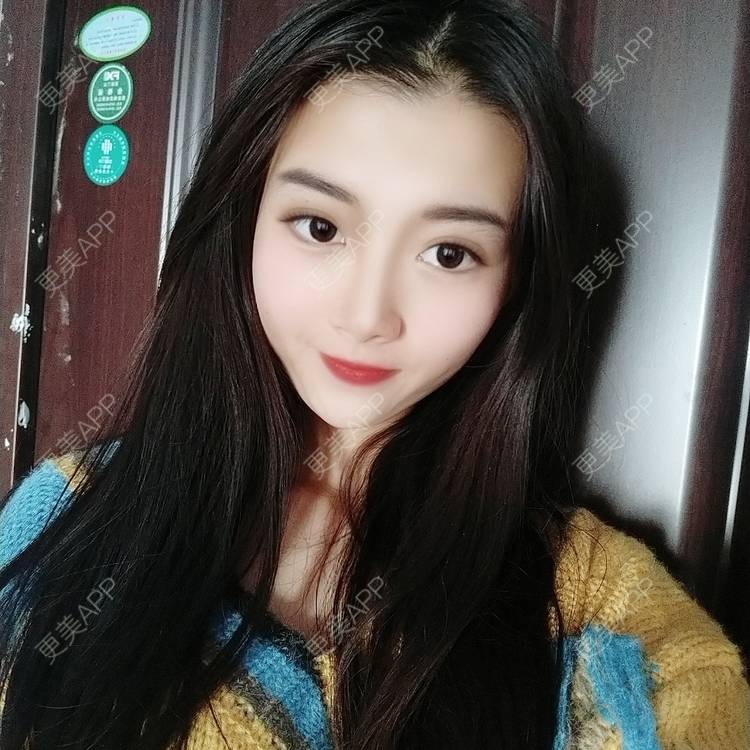 更美 - 更美用户3yM88ohDcE的眼部多项经验 | 眼部多项 | 广州 | 视频日记