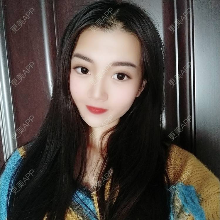 更美 - 更美用户3yM88ohDcE的眼部多项经验 | 眼部多项 | 广州 | 视频日记