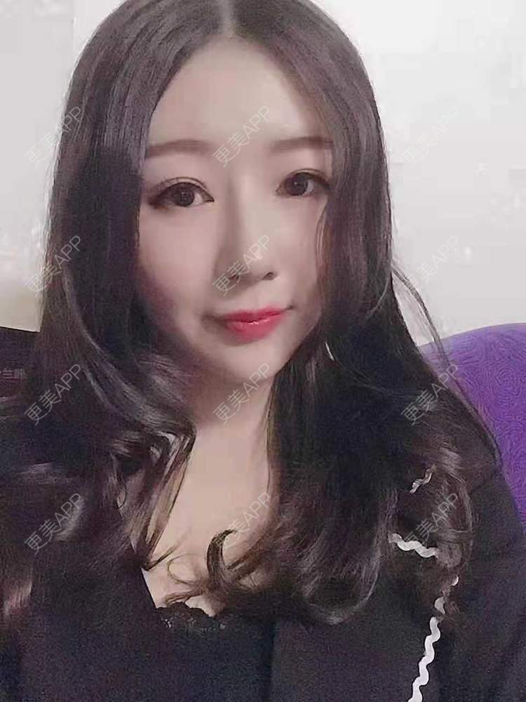 更美 - 更美用户oddCuSyrcj的鼻部多项经验 | 广州 | 鼻部多项