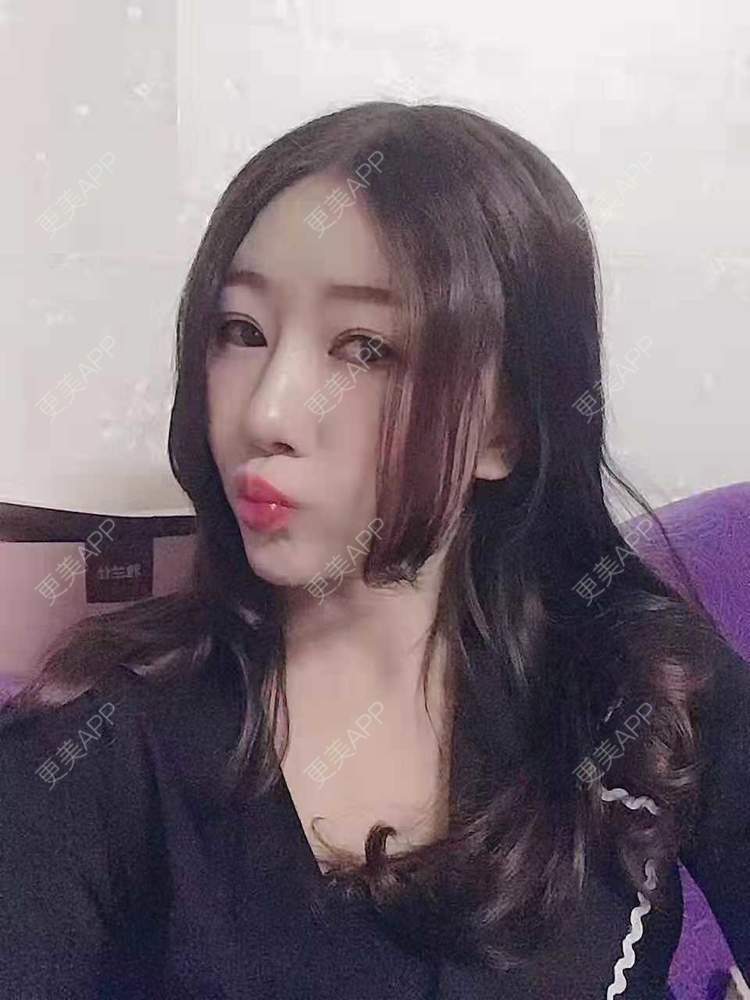 更美 - 更美用户oddCuSyrcj的鼻部多项经验 | 广州 | 鼻部多项