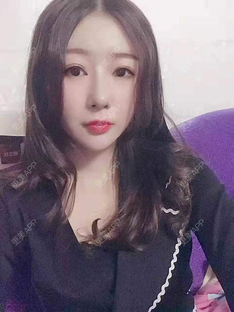 更美 - 更美用户oddCuSyrcj的鼻部多项经验 | 广州 | 鼻部多项