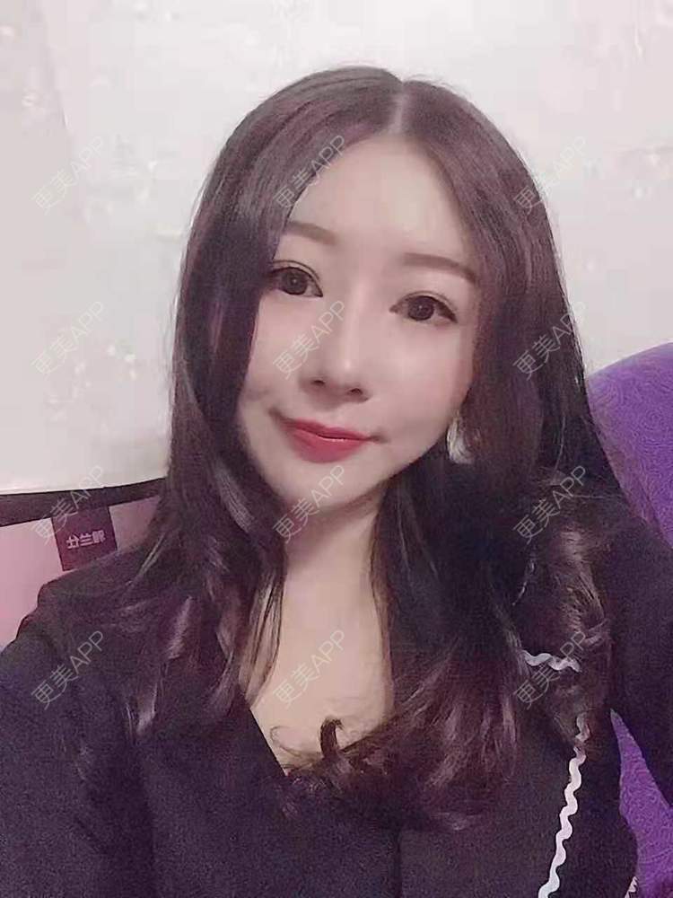 更美 - 更美用户oddCuSyrcj的鼻部多项经验 | 广州 | 鼻部多项