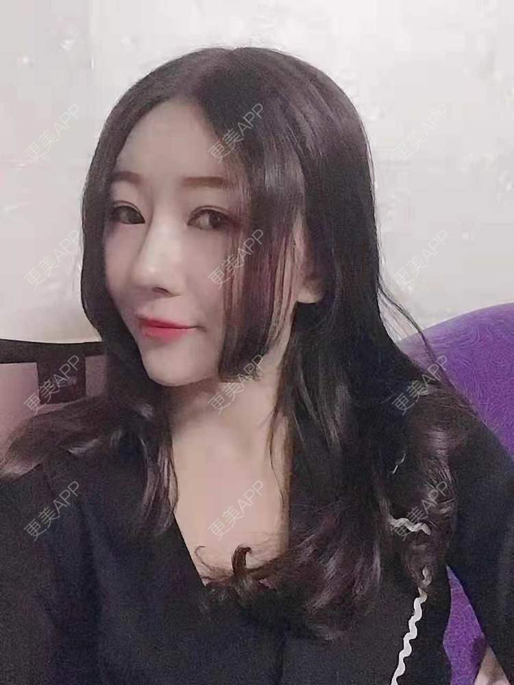 更美 - 更美用户oddCuSyrcj的鼻部多项经验 | 广州 | 鼻部多项