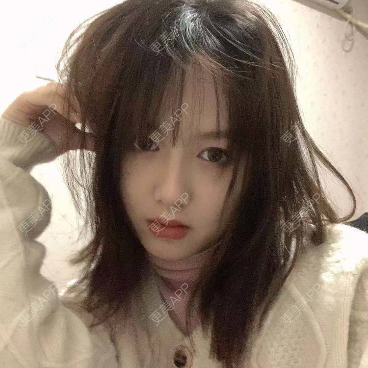 更美 - 小雨小鱼小玉的定点双眼皮经验 | 成都 | 视频日记 | 全切双眼皮 | 定点双眼皮