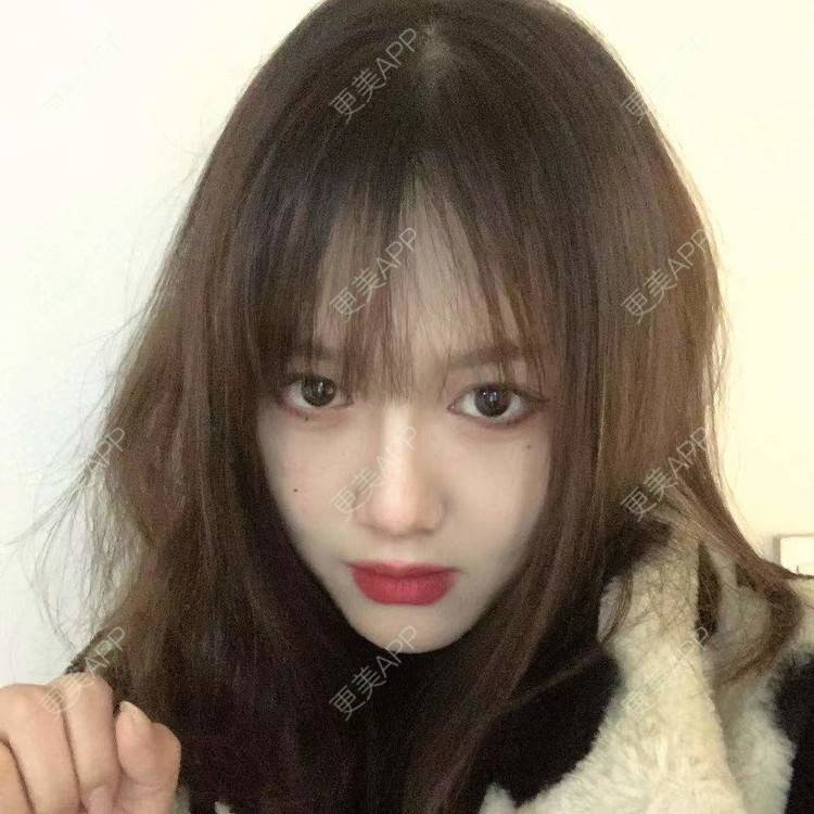 更美 - 小雨小鱼小玉的定点双眼皮经验 | 成都 | 视频日记 | 全切双眼皮 | 定点双眼皮