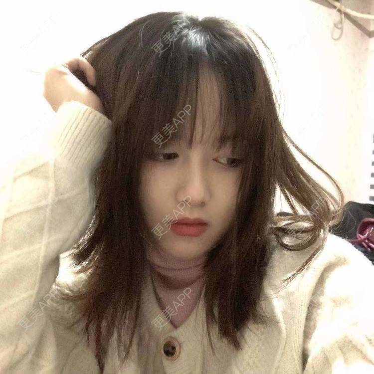 更美 - 小雨小鱼小玉的定点双眼皮经验 | 成都 | 视频日记 | 全切双眼皮 | 定点双眼皮