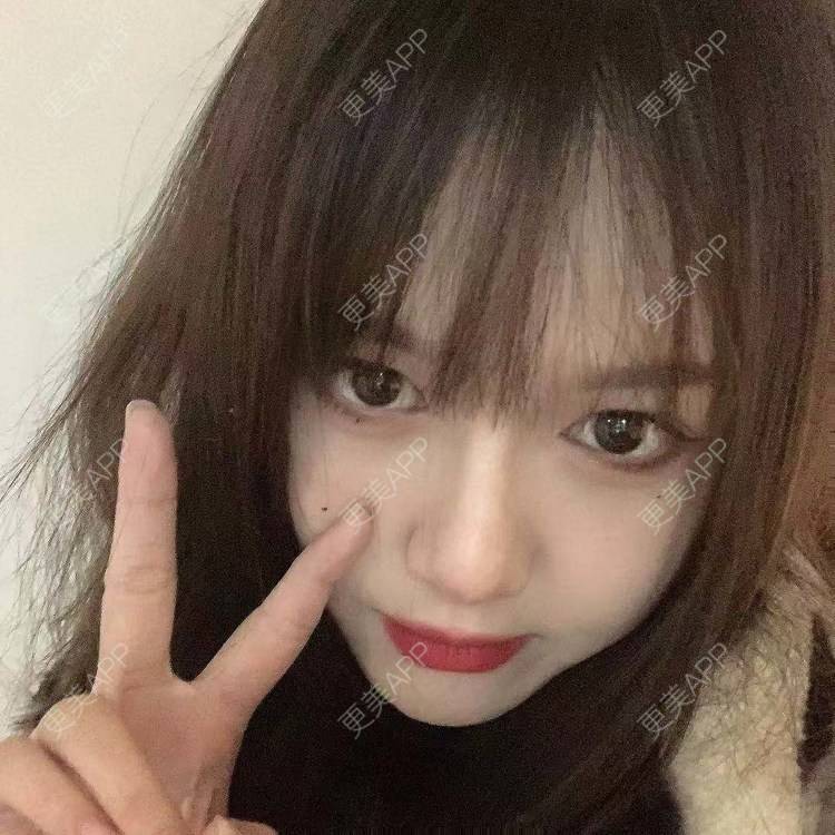 更美 - 小雨小鱼小玉的定点双眼皮经验 | 成都 | 视频日记 | 全切双眼皮 | 定点双眼皮