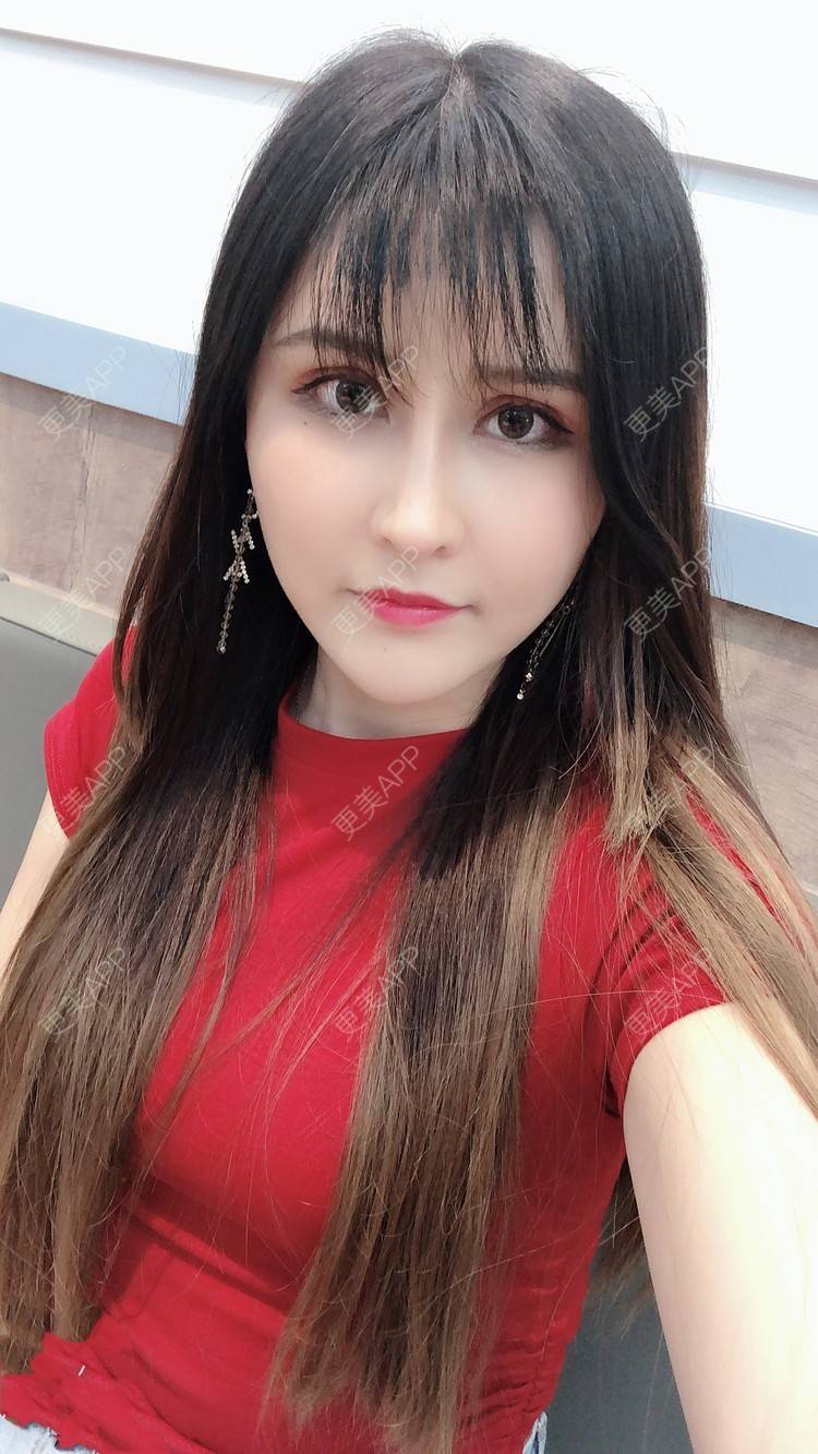 更美 - 阿依古丽💫的肋软骨隆鼻经验 | 肋软骨隆鼻 | 视频日记 | 重庆