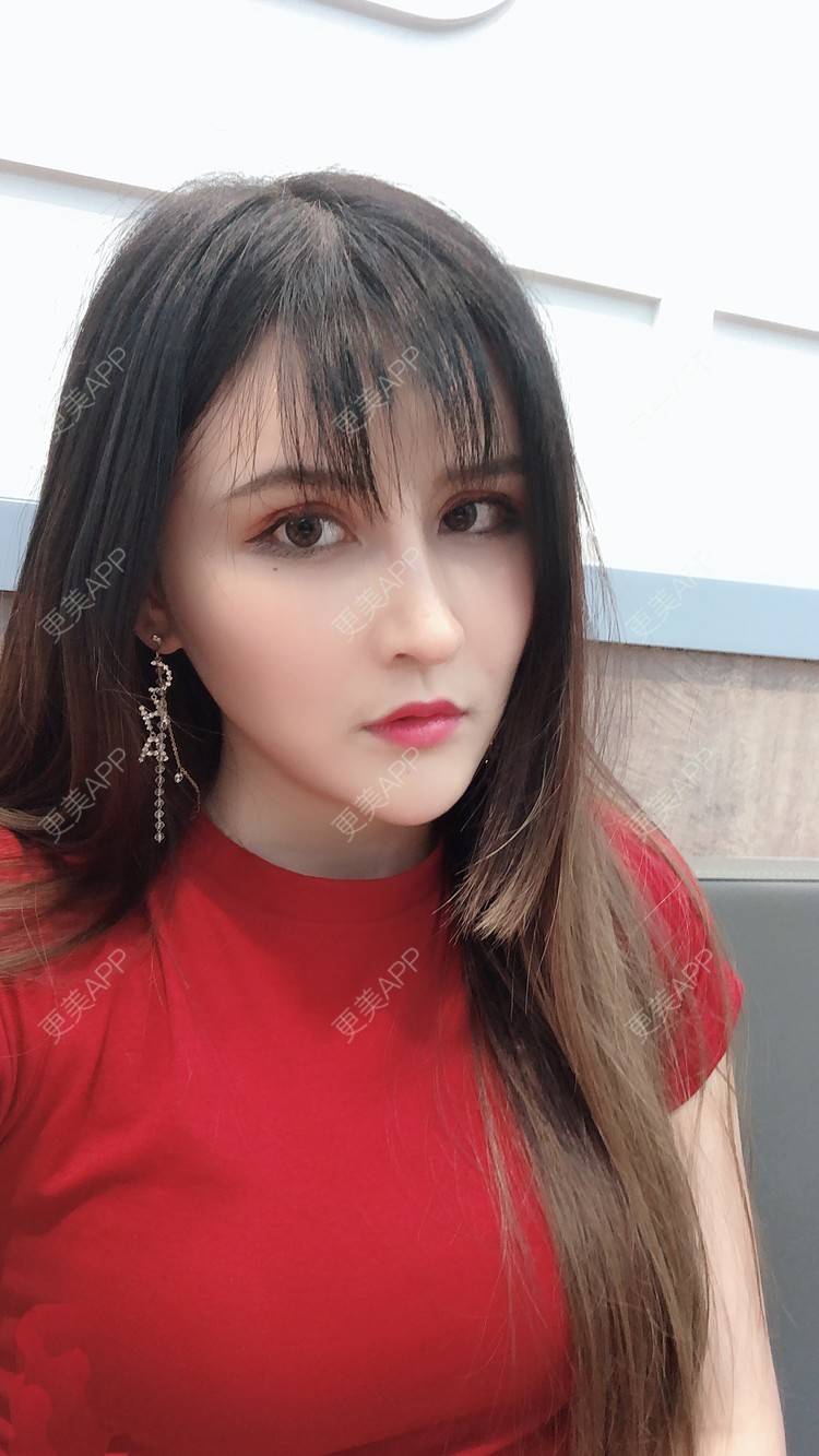 更美 - 阿依古丽💫的肋软骨隆鼻经验 | 肋软骨隆鼻 | 视频日记 | 重庆