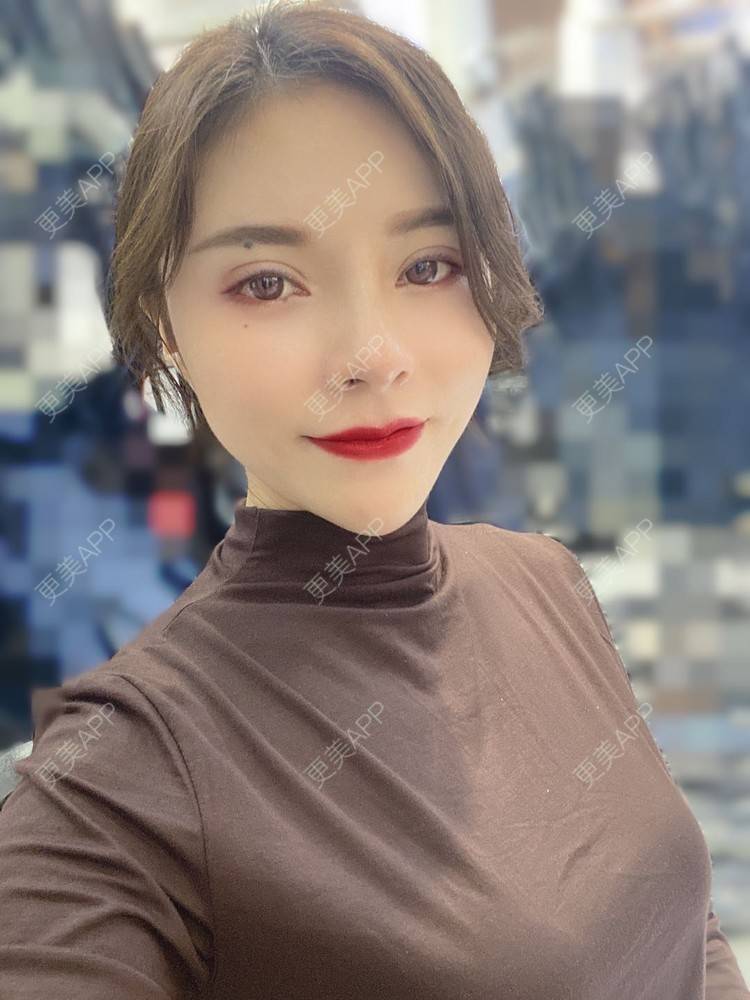 更美 - 更美用户cYoCneHuFl的鼻部多项经验 | 阳江 | 鼻部多项