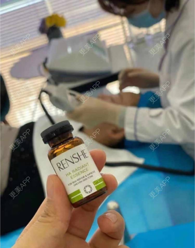 更美 - 更美用户Imdk8qvvXY的激光去脂肪粒经验 | 郑州 | 激光去脂肪粒